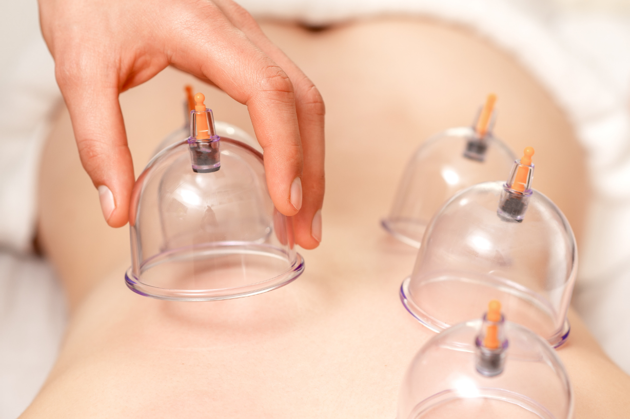 Cupping Session