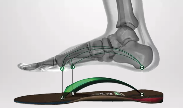 Foot Arch Evaluation and Orthotics 