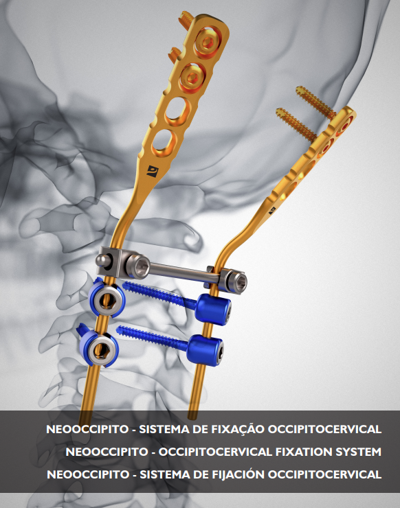 Sistema de Fixação Occipitocervical Neooccipito - NEOORTHO