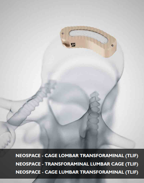 Neospace Cage Lombar Transforminal (TLIF)