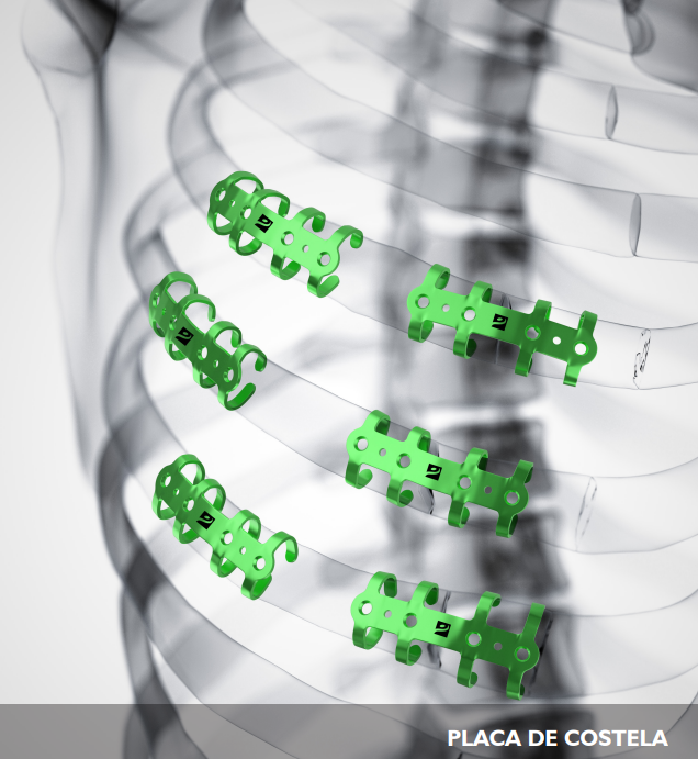 Placa de Costela