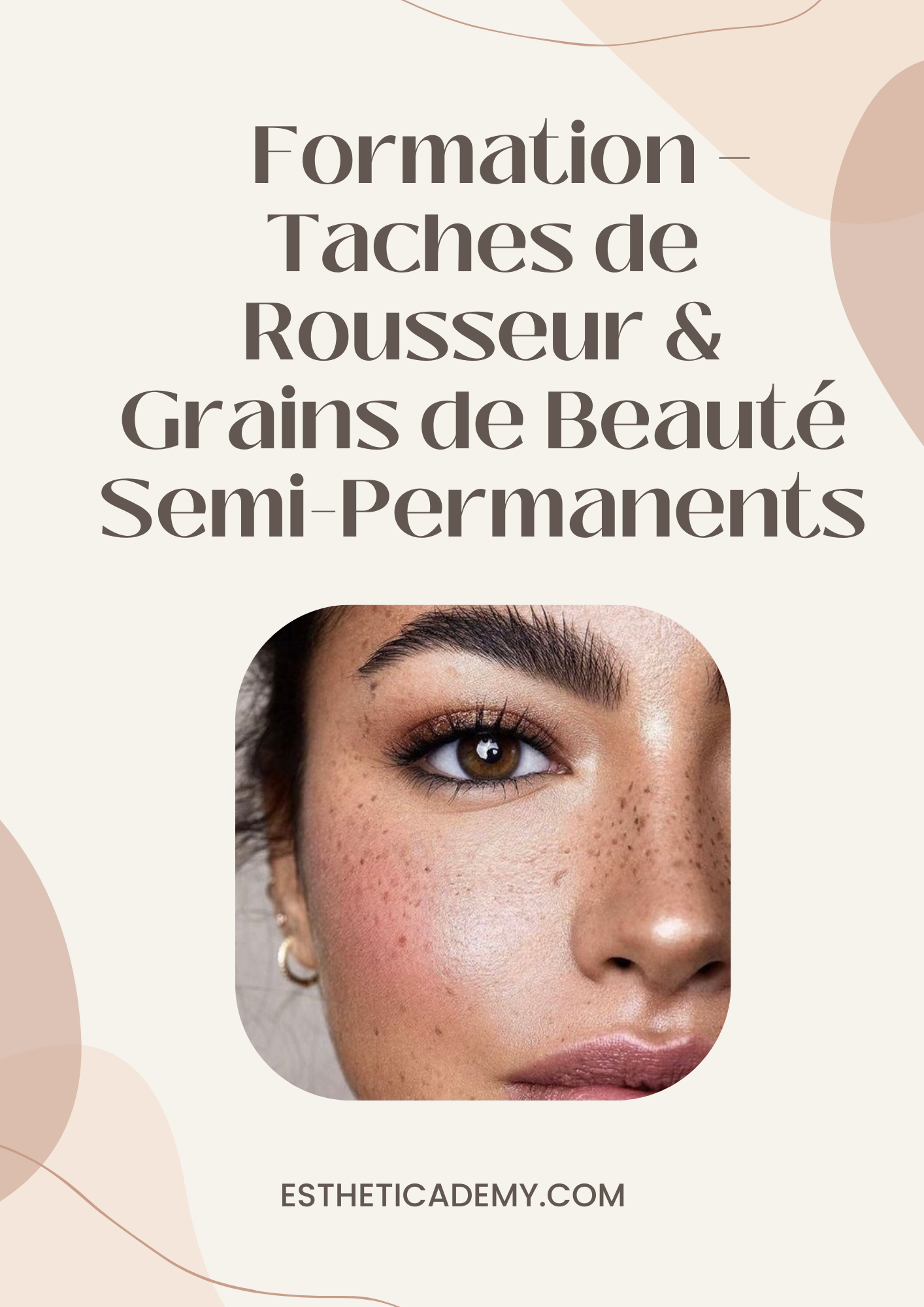 Formation Taches de Rousseur & Grains de Beauté Semi-Permanents