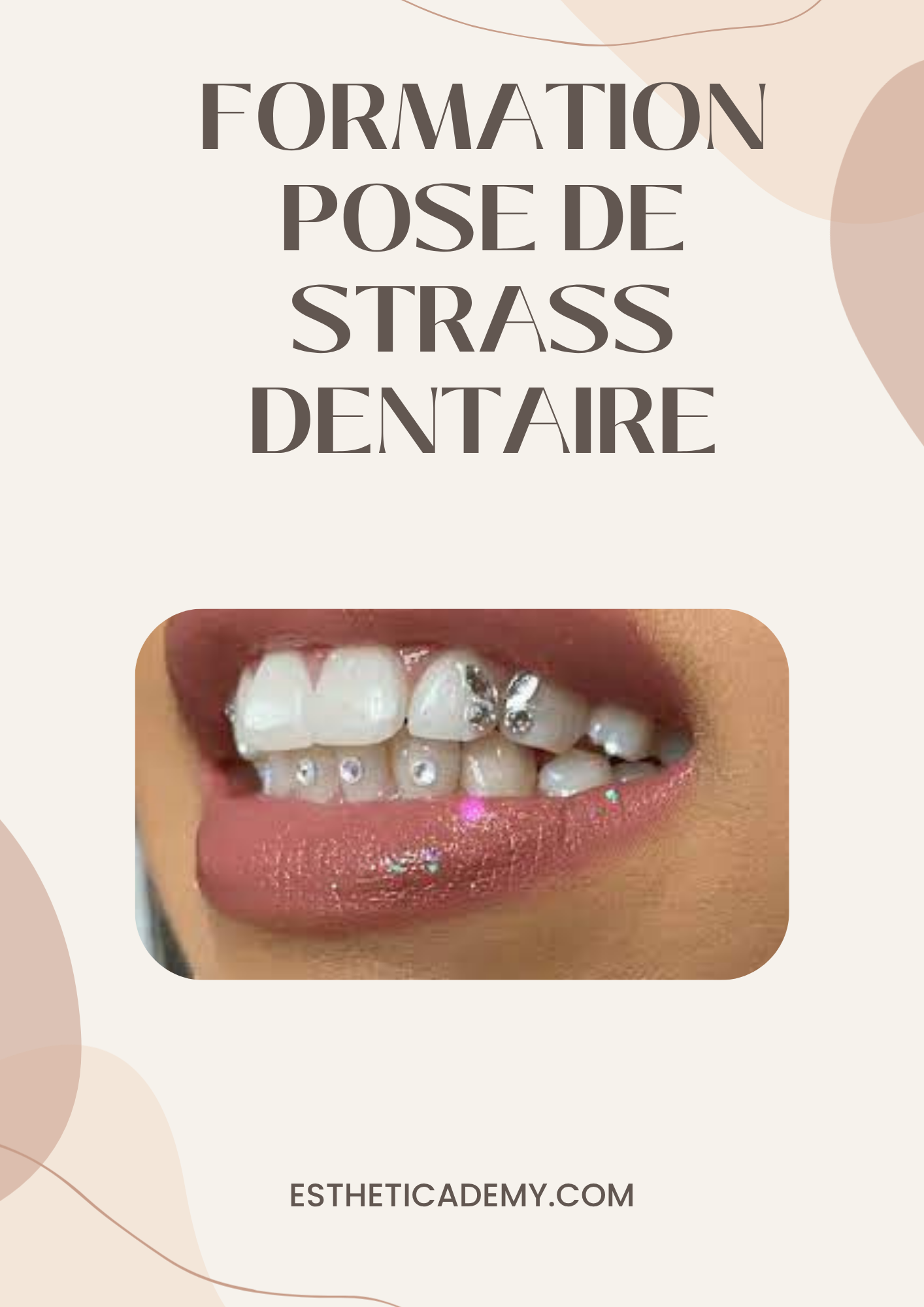 Formation Strass Dentaire
