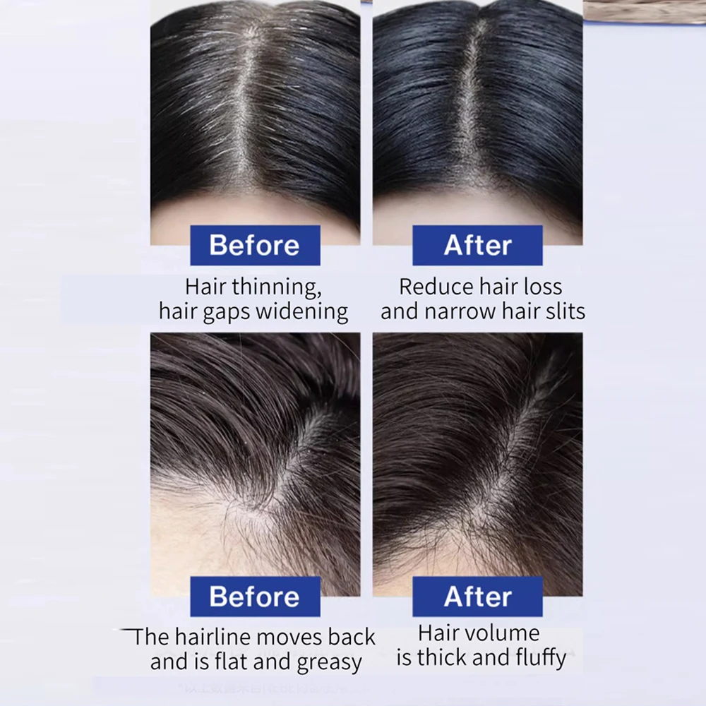 FEG Hair Loss and Strengthening Hair Care Oil For Men And Women