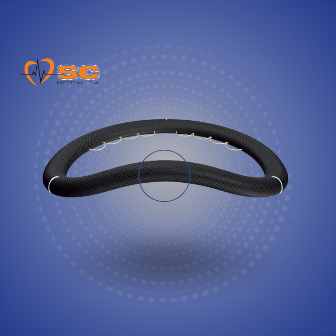 Anillo Mitral Memo 4D™