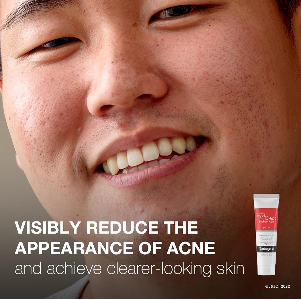 Gel de tratamiento de manchas para el acné