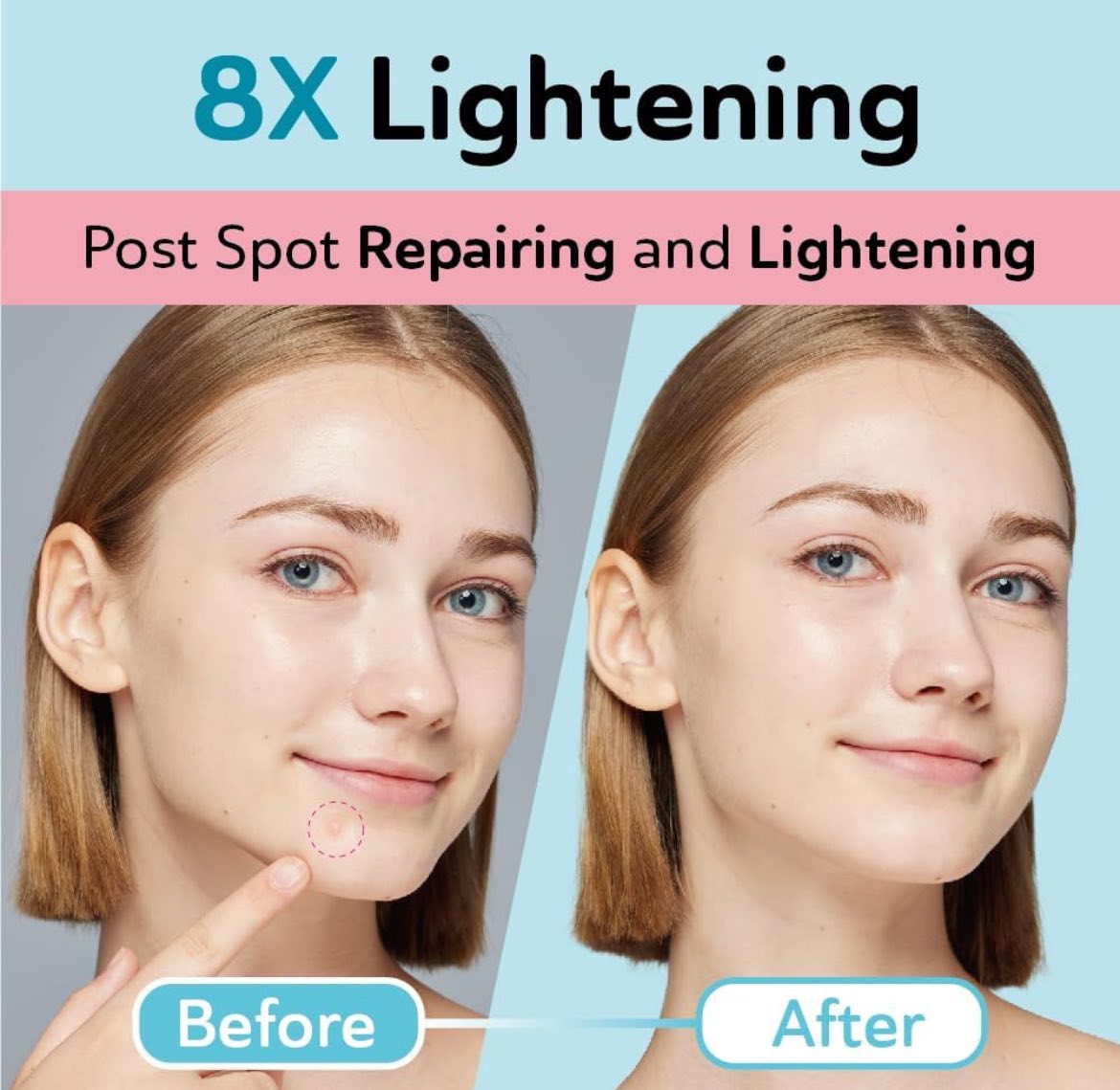 Parches para acné y post-acné