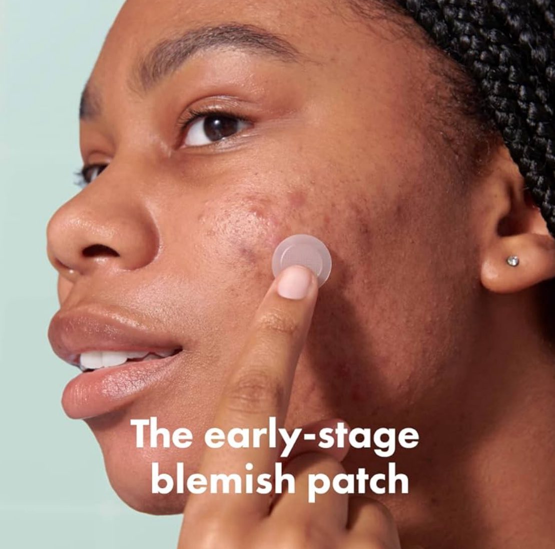 Parches para espinillas