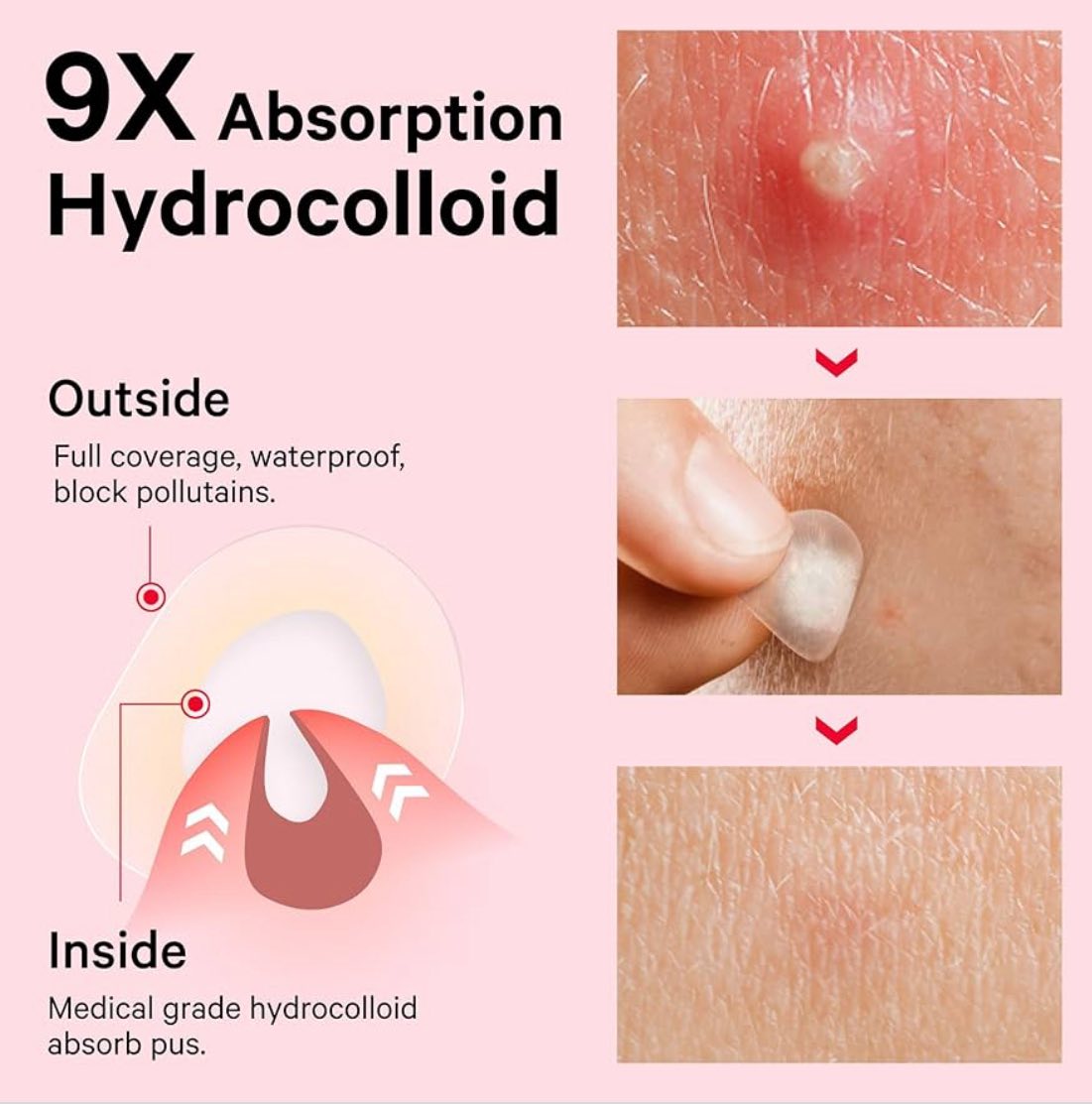 Parches de espinillas