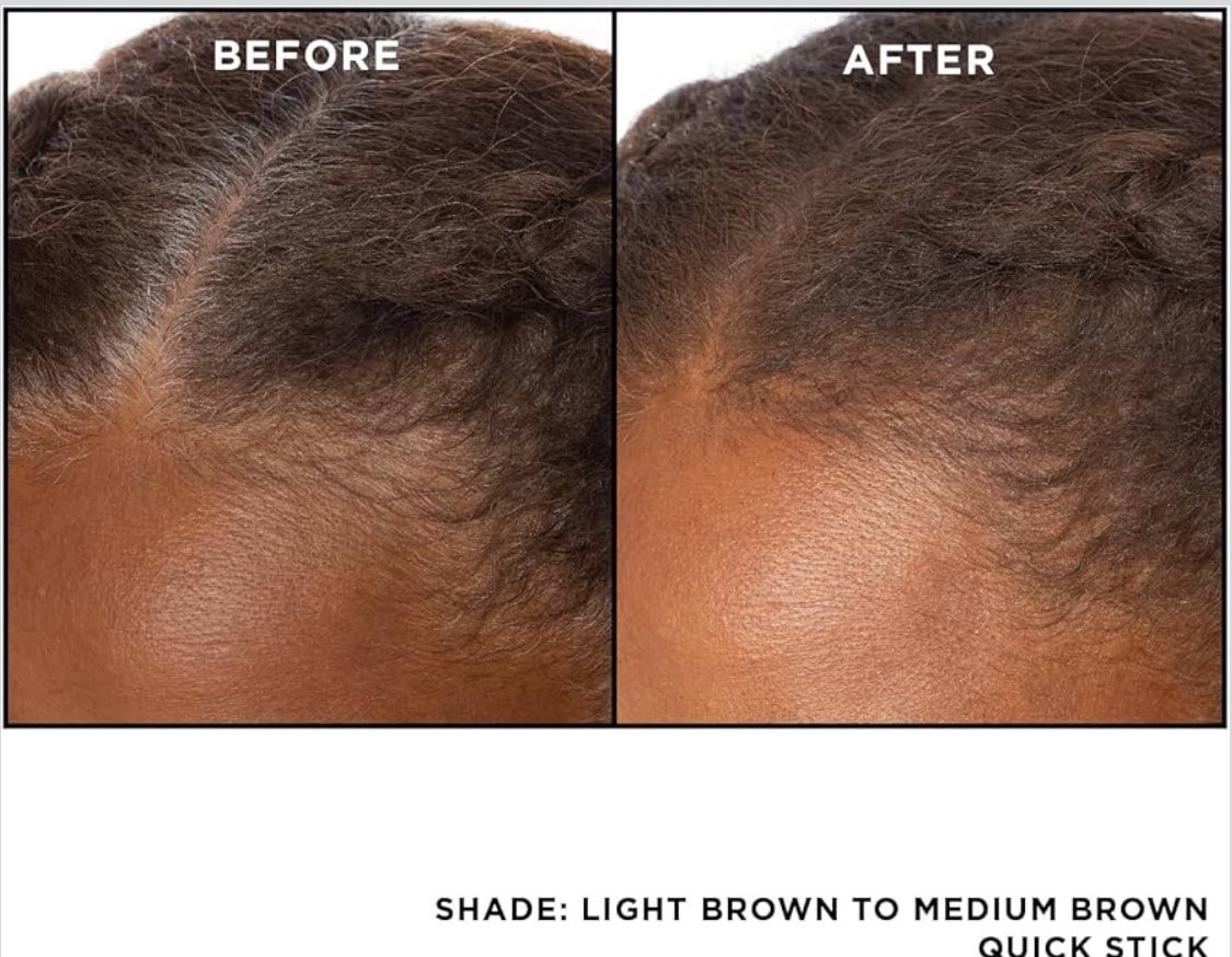 Barra de retoque de raíz