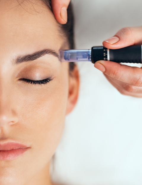 Dermapen – Microneedling Facial
