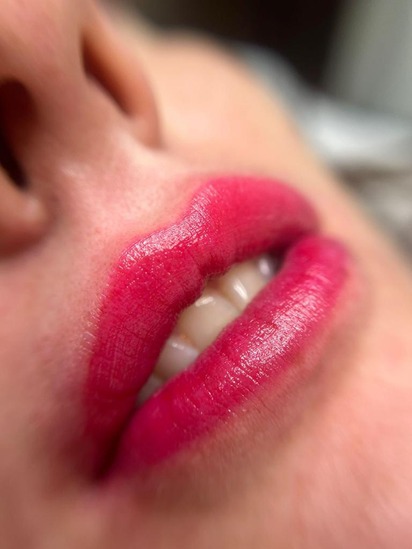 Full Lips