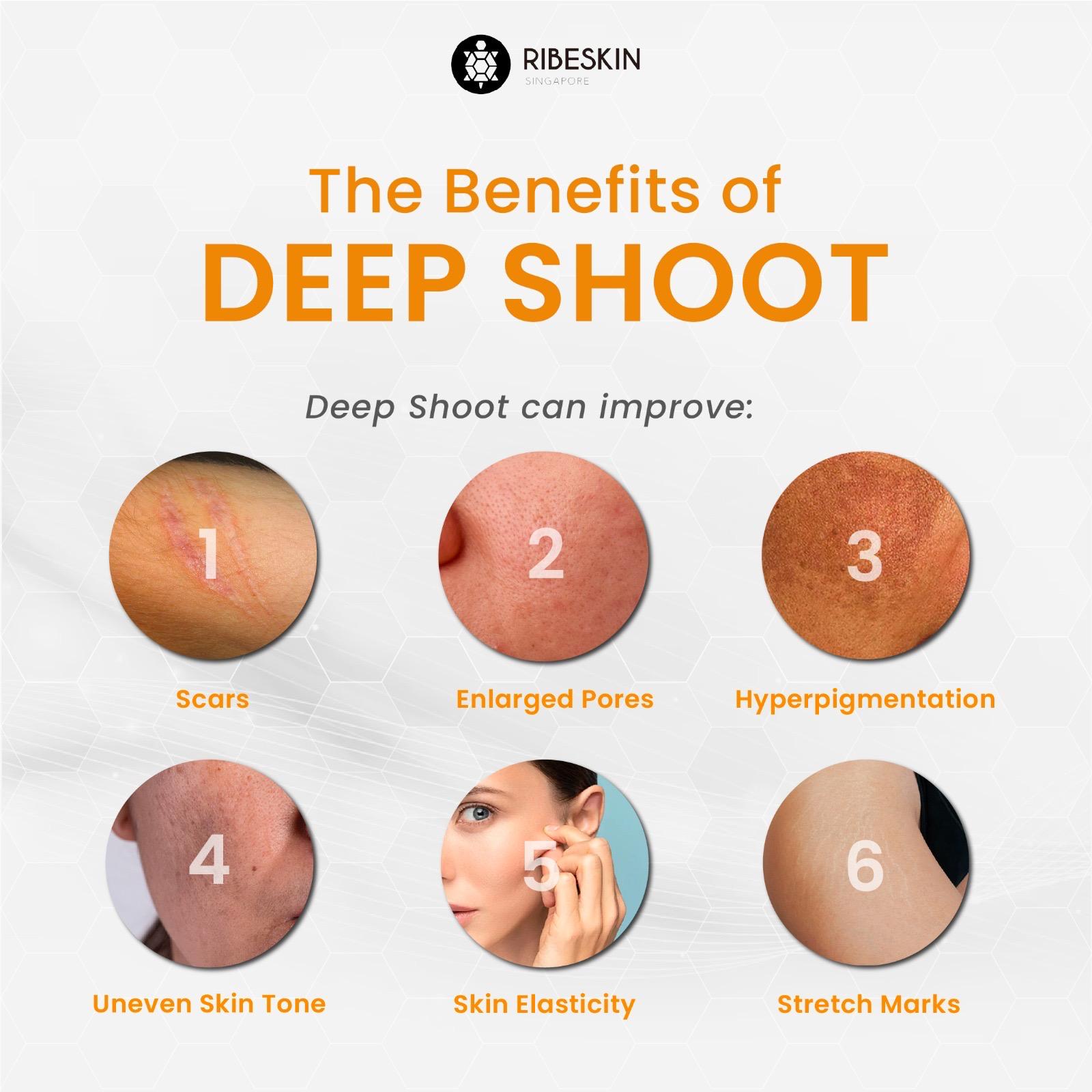 Deep Shoot