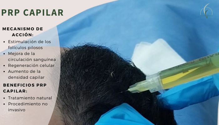 Cita con Experto en Recuperación Capilar