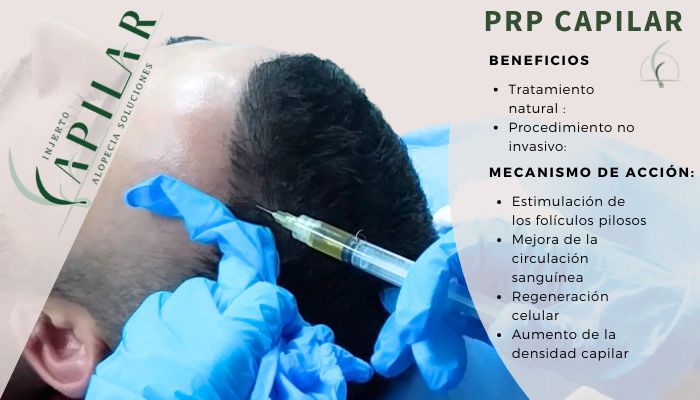 Cita con Experto en Recuperación Capilar 