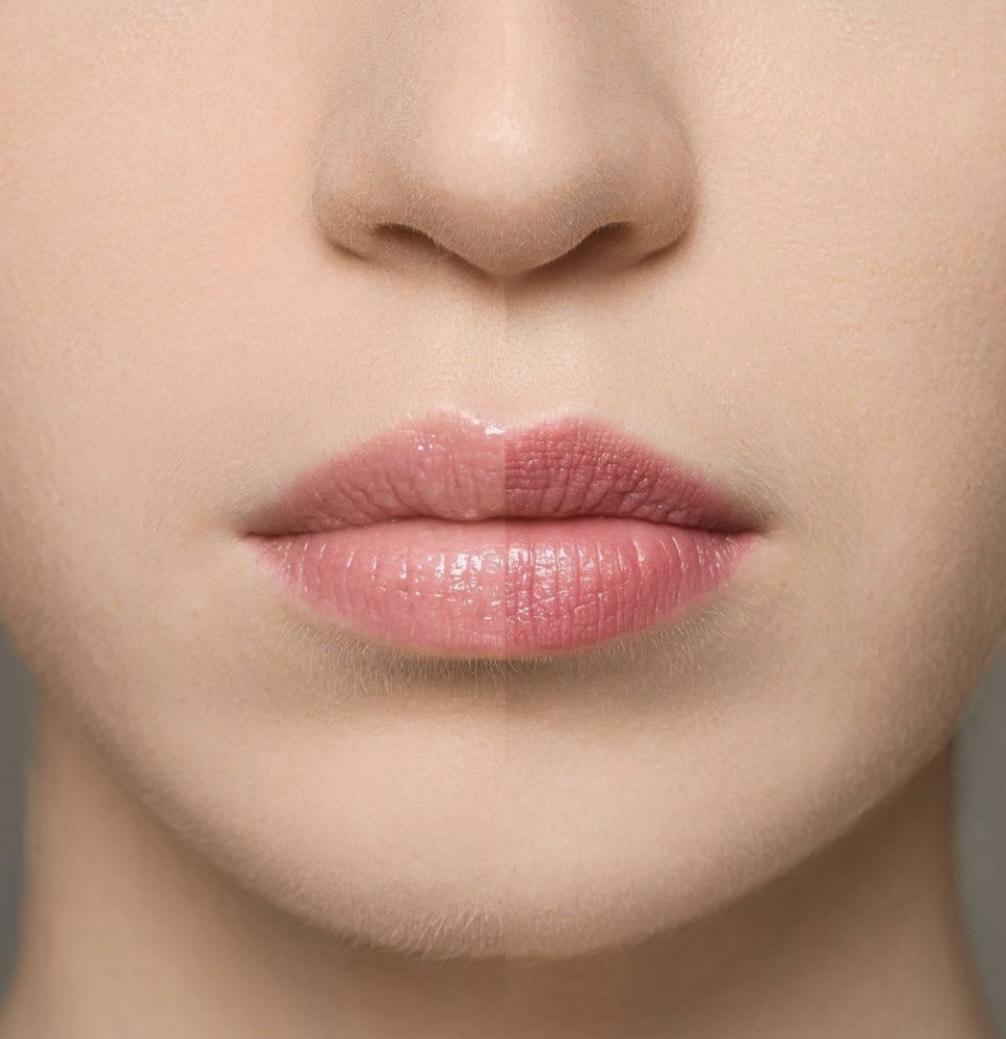 Supreme Lip Treatment Erdbeere MM003