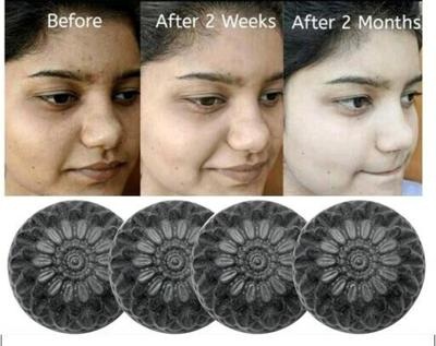 GlowMe Herbal  Activated Charcoal Soaps  80 Gm