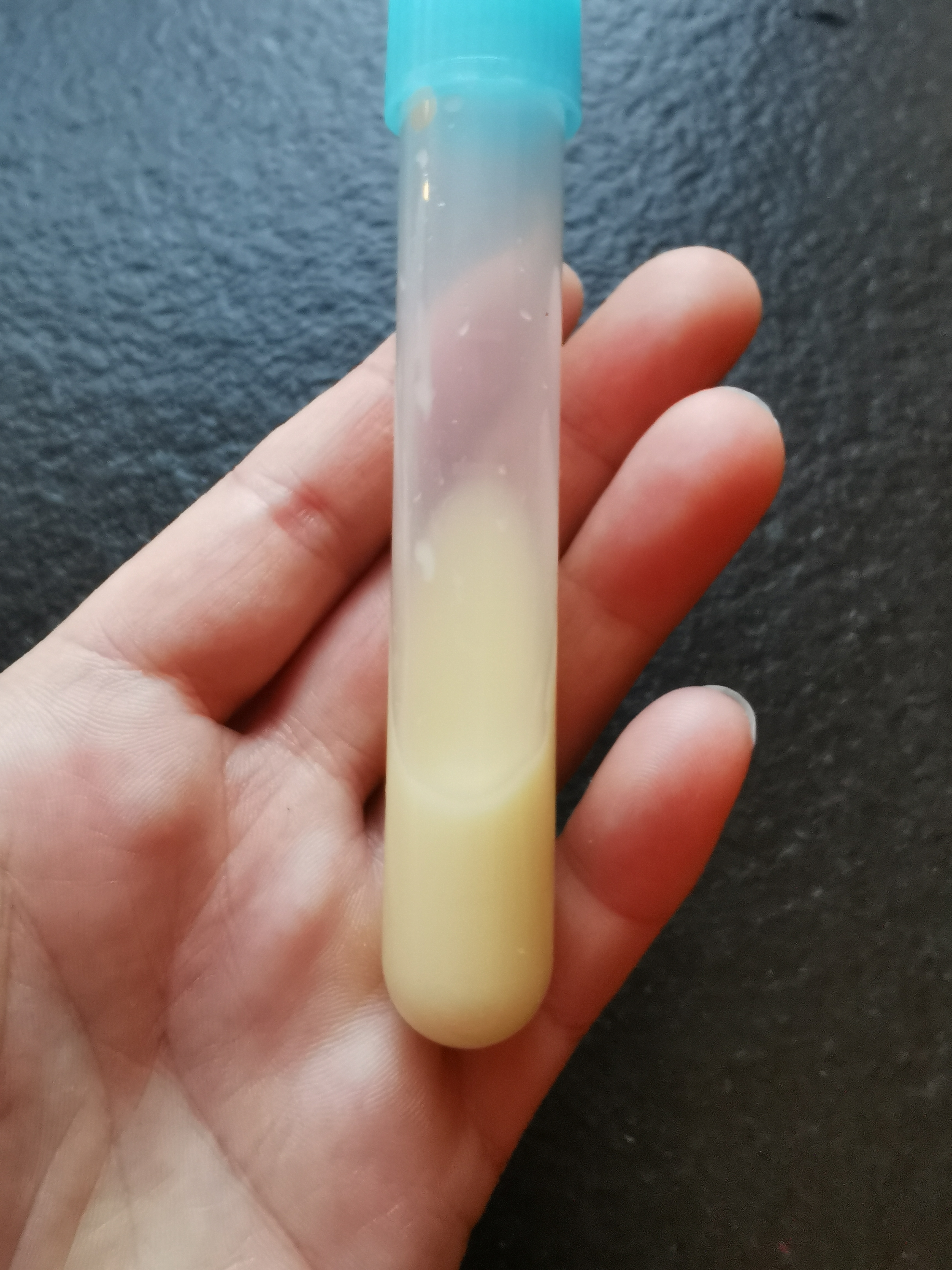 Versandkit für die Konservierung deiner Muttermilch (10ml) 