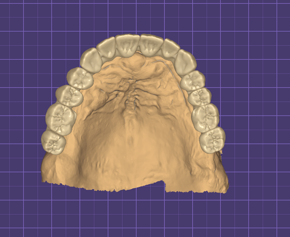 Wax up numérique  /u