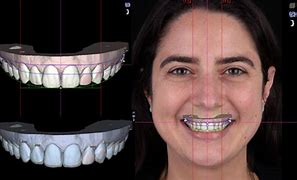 Digital Smile Design