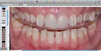 Digital Smile Design                