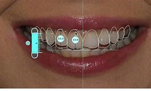 Digital Smile Design                