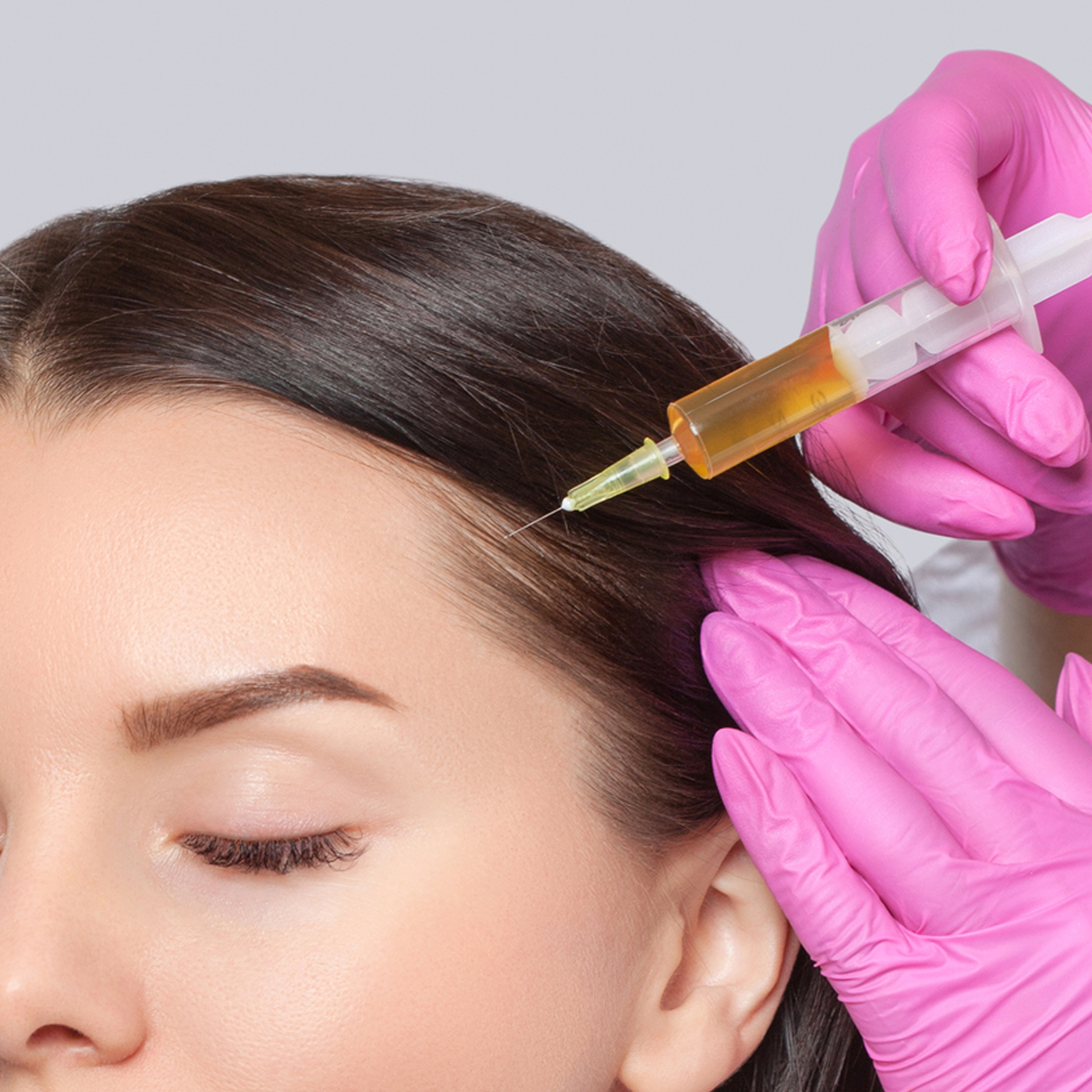 Exosomes Injection for Face and Hair