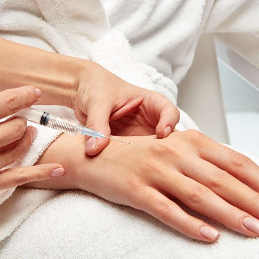 Back of Hands Filler