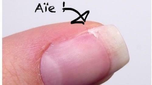 Garantie casse ou décollement