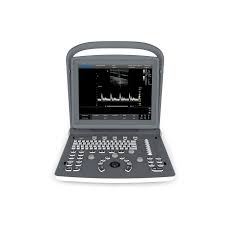 ECÓGRAFO CHISON ECO 2