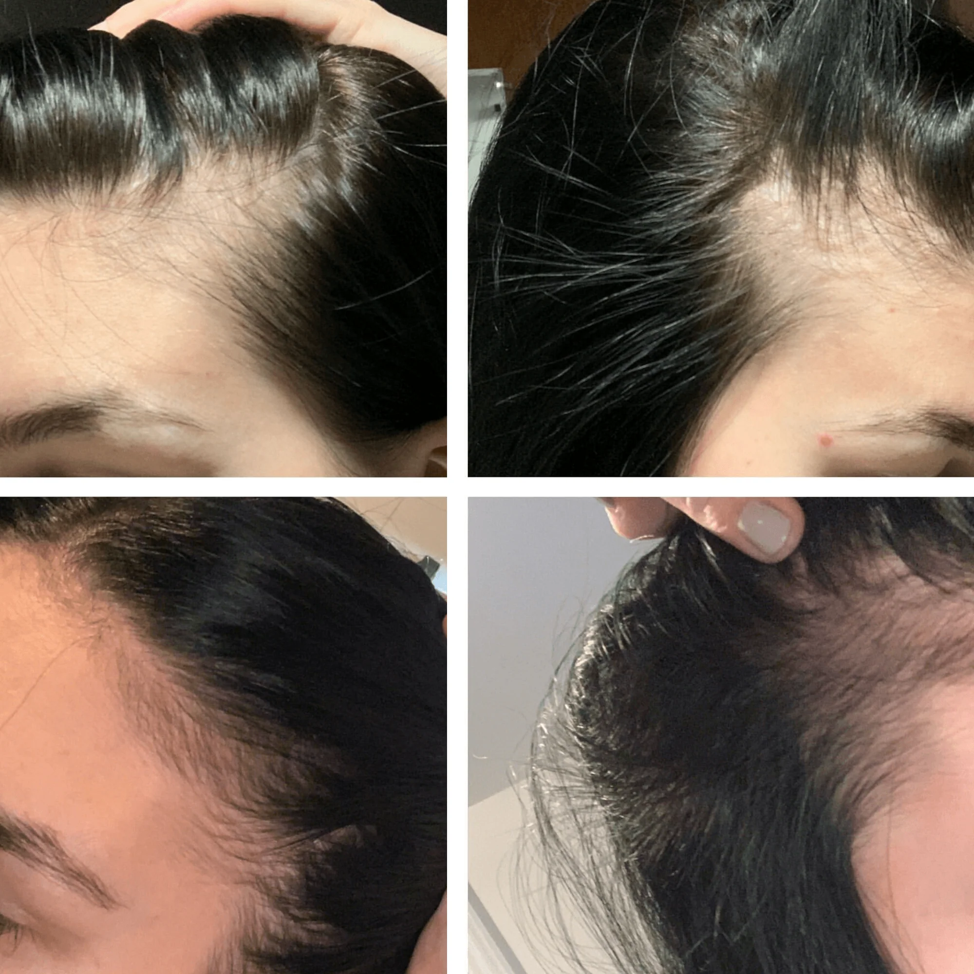 L'ORÉAL. SÉRIE EXPERT SÉRUM DENSIFIANT SERIOXYL ADVANCED - 90 ML