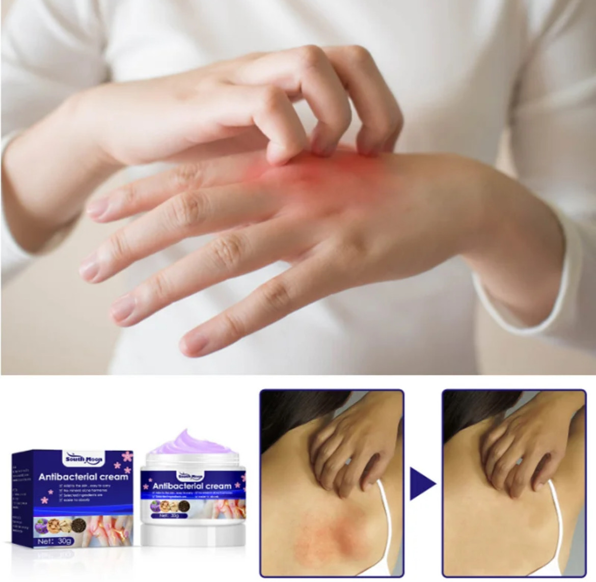 Antibacterial Cream Antibacterial Ointment Remove Odor Pruritus Dermatitis Genital Vulva Itching Thigh Inside Itch Private Cream