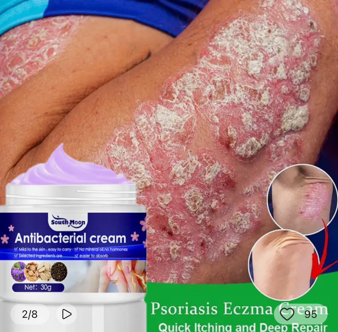 Antibacterial Cream Antibacterial Ointment Remove Odor Pruritus Dermatitis Genital Vulva Itching Thigh Inside Itch Private Cream