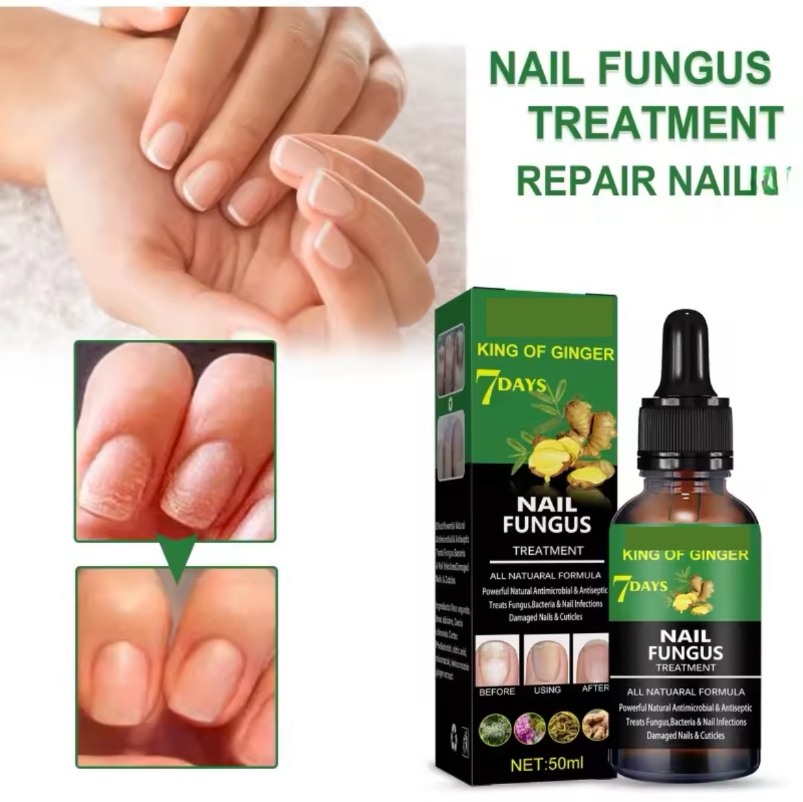 Nail Fungus Treatment Serum 7 days perfect solution