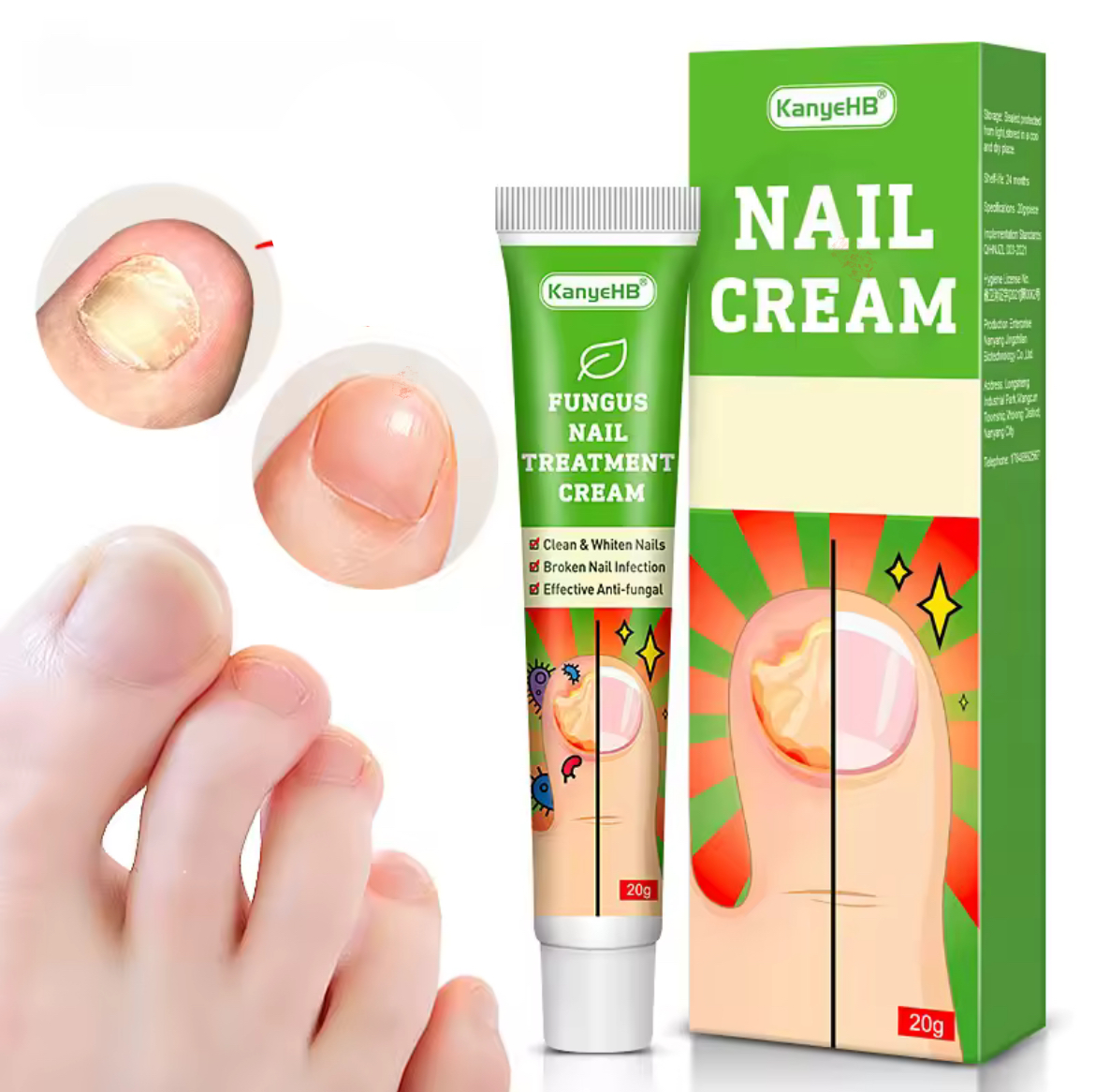 Fungus Nail Treatment Cream Effective nail fungal infection solution