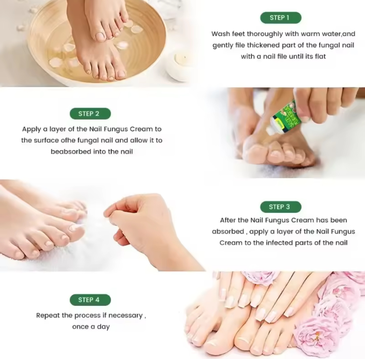 Fungus Nail Treatment Cream Effective nail fungal infection solution