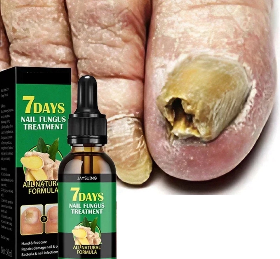 7 Days Nail Fungus Treatment Serum