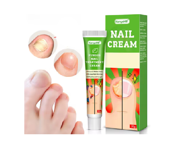 Fungus Nail Treatment Cream Effective nail fungal infection solution