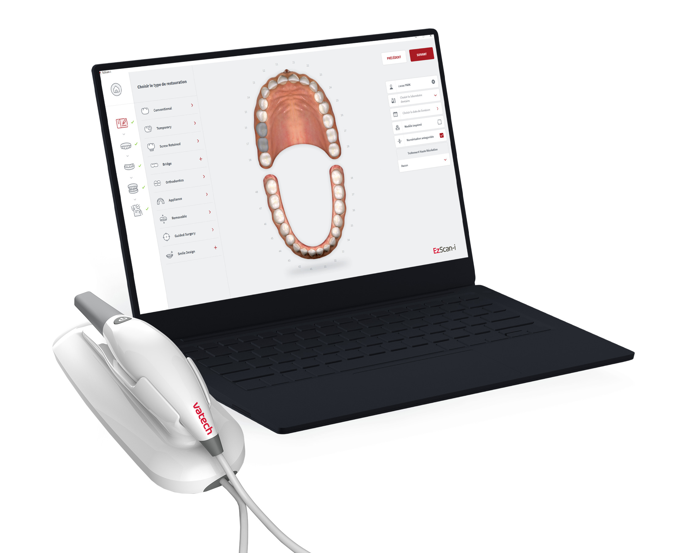 EzScan Caméra Intraorale | VATECH