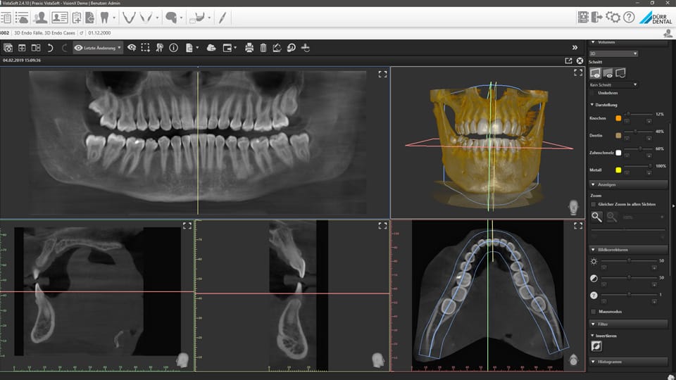 VistaVox S | DÜRR DENTAL