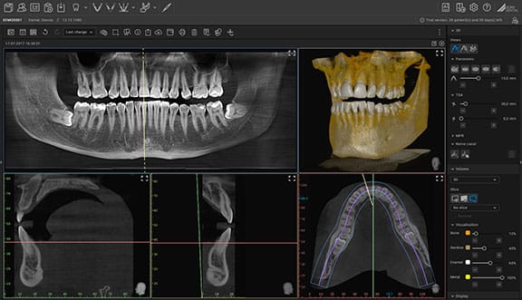 VistaSoft 3D | DÜRR DENTAL