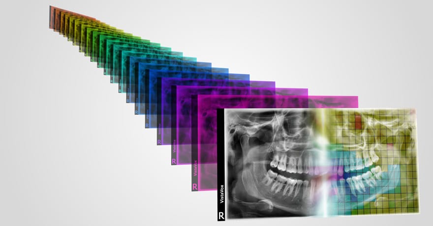 Technologie S-Pan | DÜRR DENTAL
