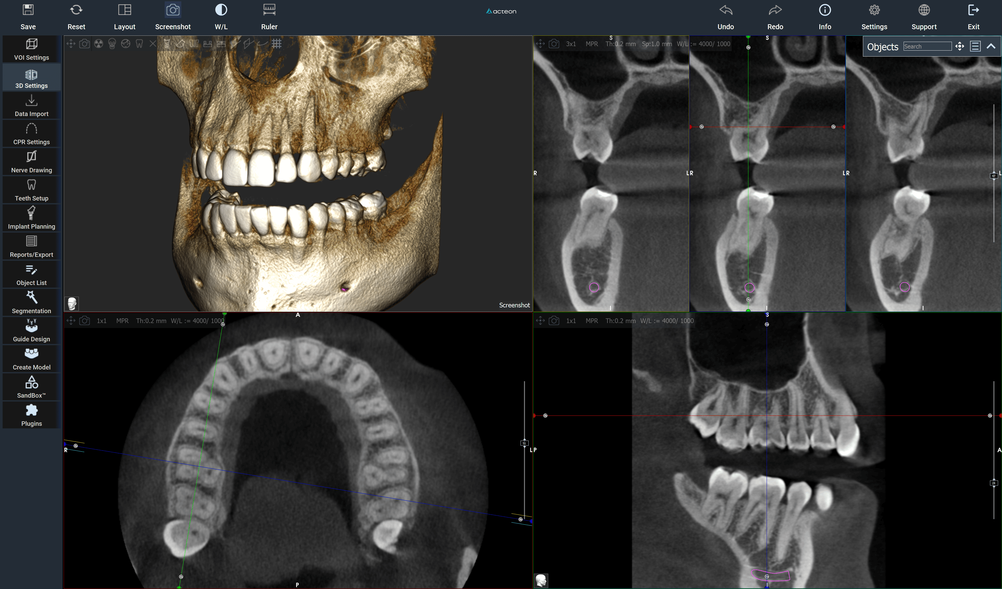 Logiciel d'imagerie AIS | ACTEON® Imaging Suite