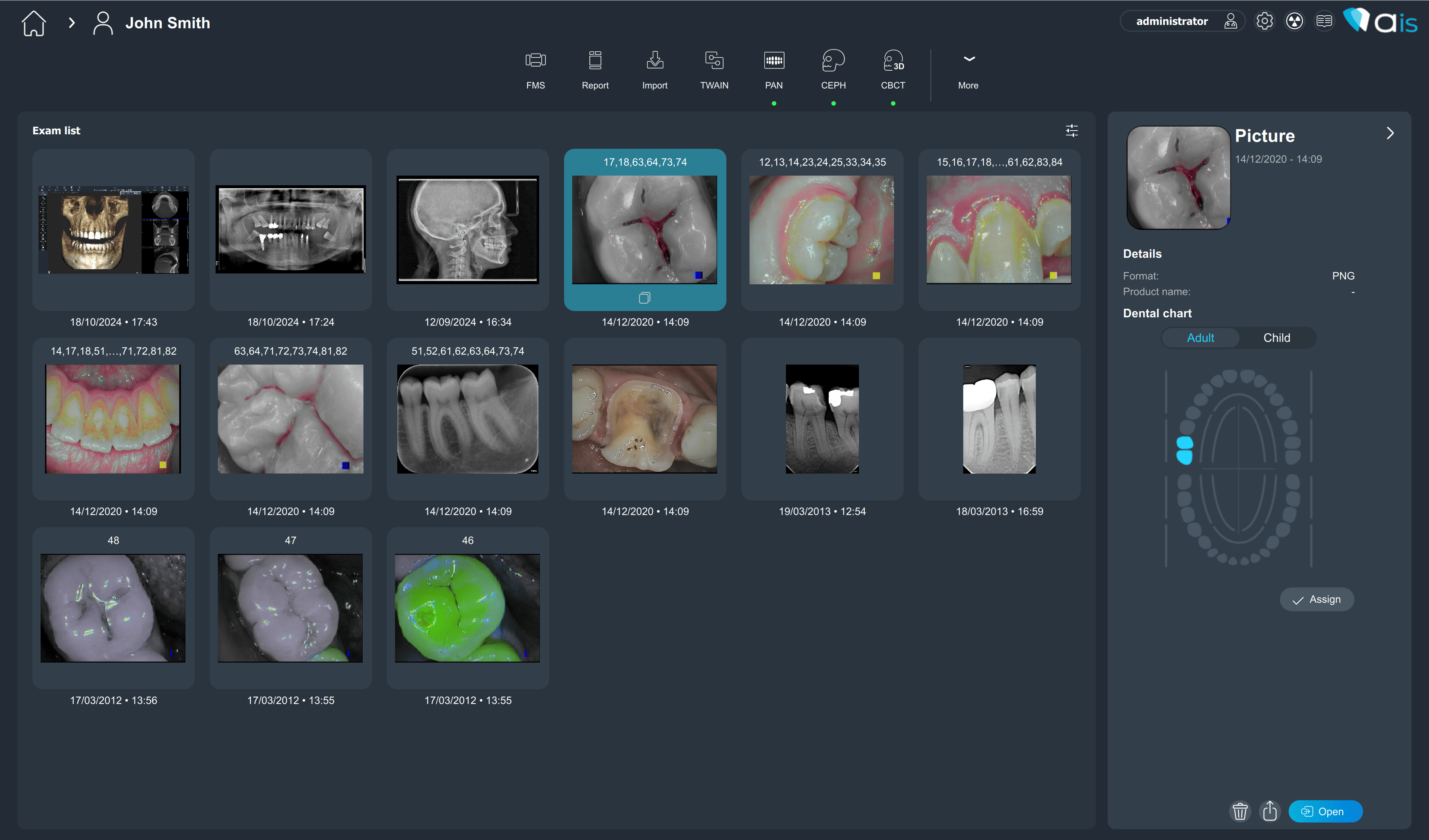 Logiciel d'imagerie AIS | ACTEON® Imaging Suite