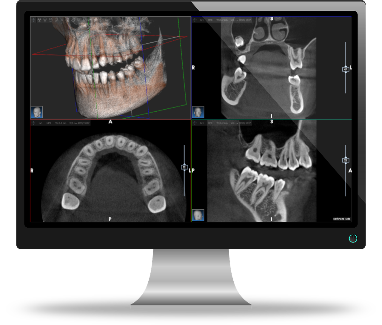 Logiciel d'imagerie AIS | ACTEON® Imaging Suite