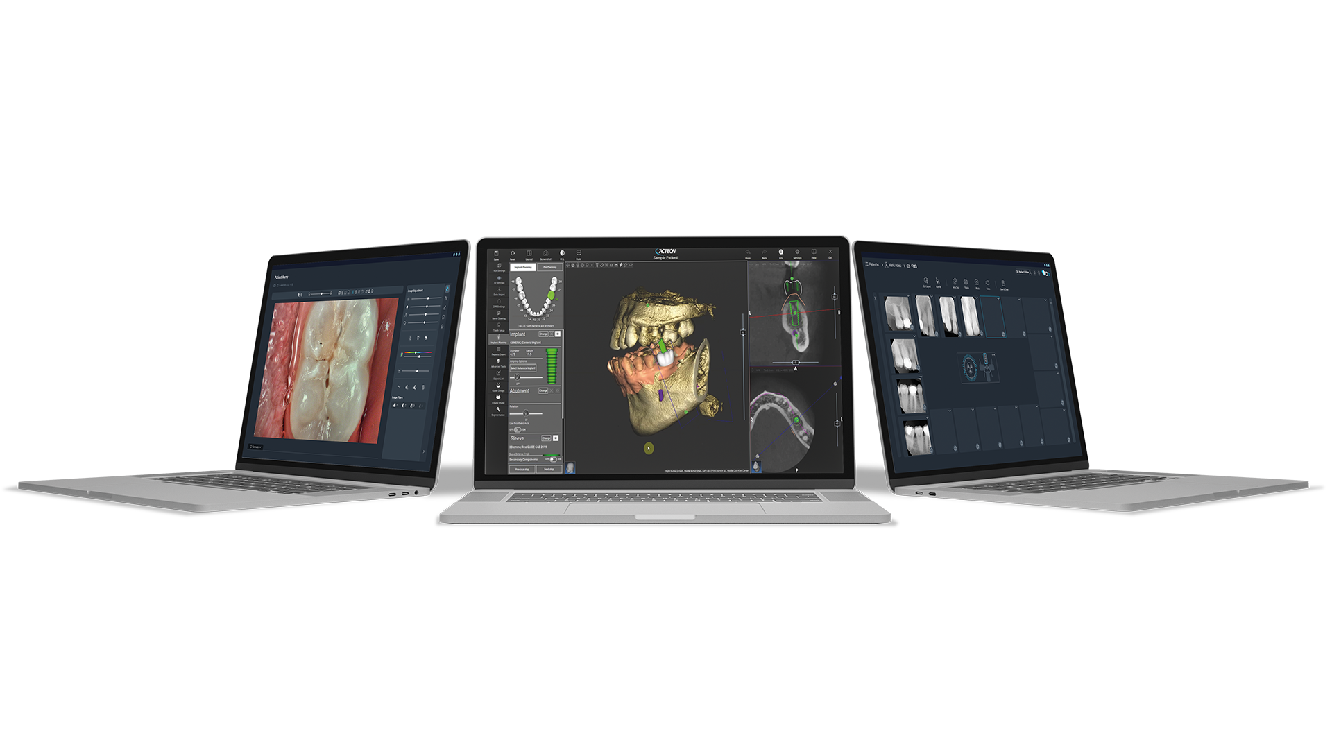 Logiciel d'imagerie AIS | ACTEON® Imaging Suite