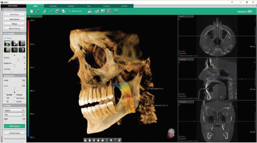 Logiciel d'imagerie Ez3D-i | VATECH