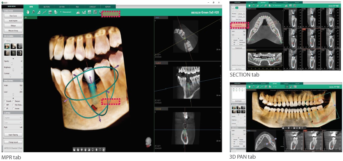 Logiciel d'imagerie Ez3D-i | VATECH