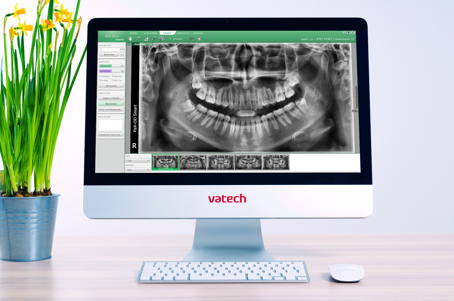 Logiciel d'imagerie EzDent-i | VATECH