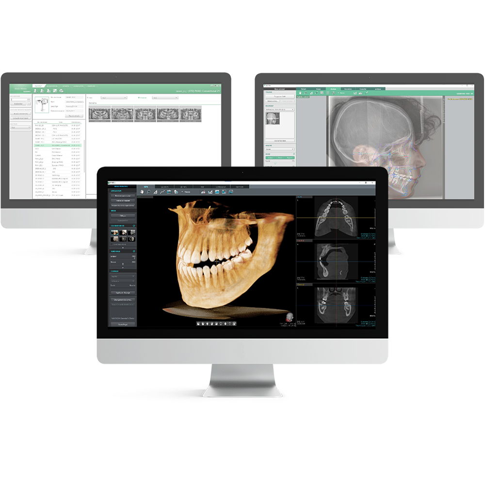Logiciel d'imagerie EzDent-i | VATECH